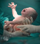 לידה אחרי ניתוח קיסרי - תמונת אווירה